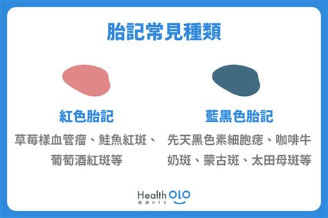 胎記位置|胎記怎麼產生、何時消除？醫師剖析胎記種類、胎記寓意